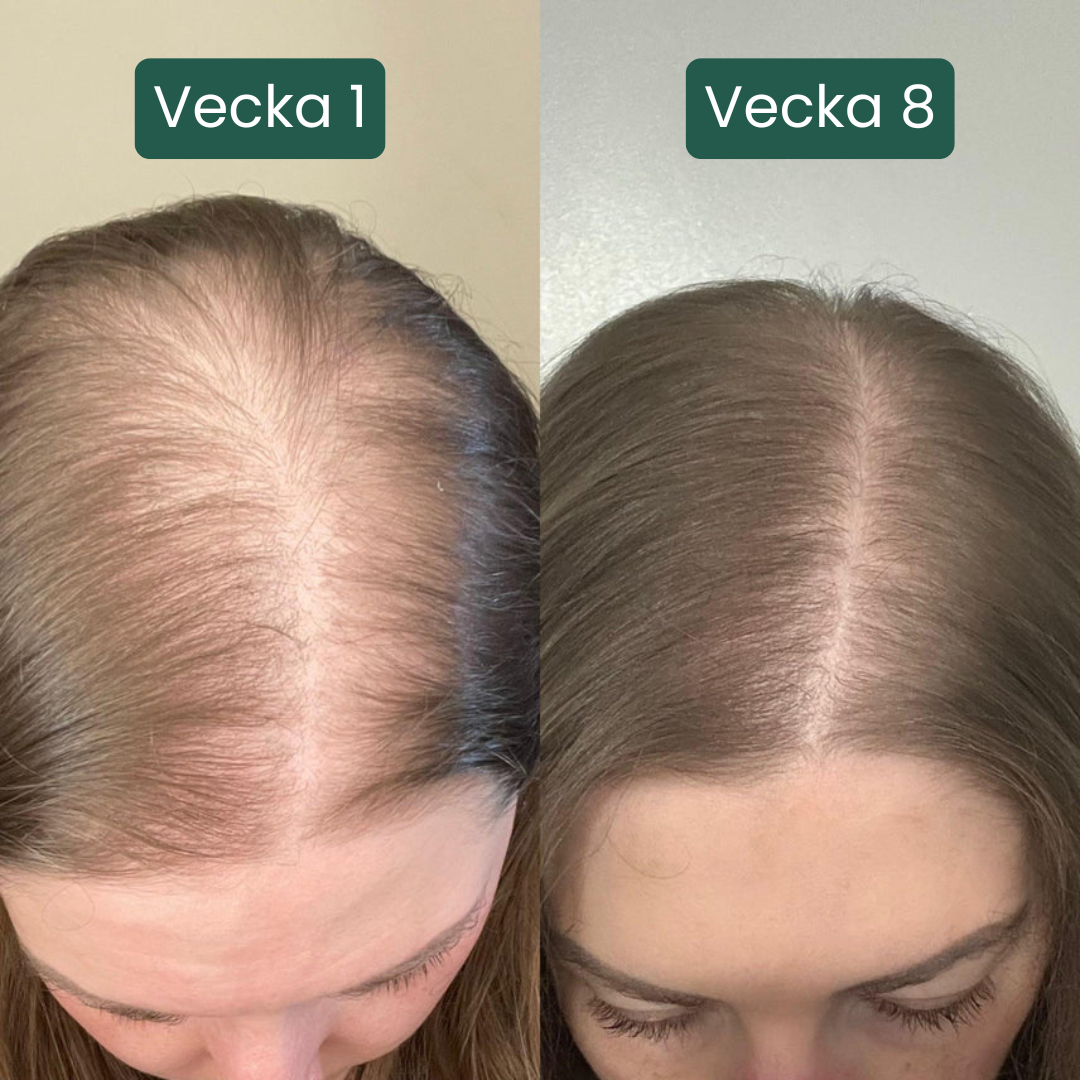 DensirRoll™ - Fylligare look där benan syns som mest