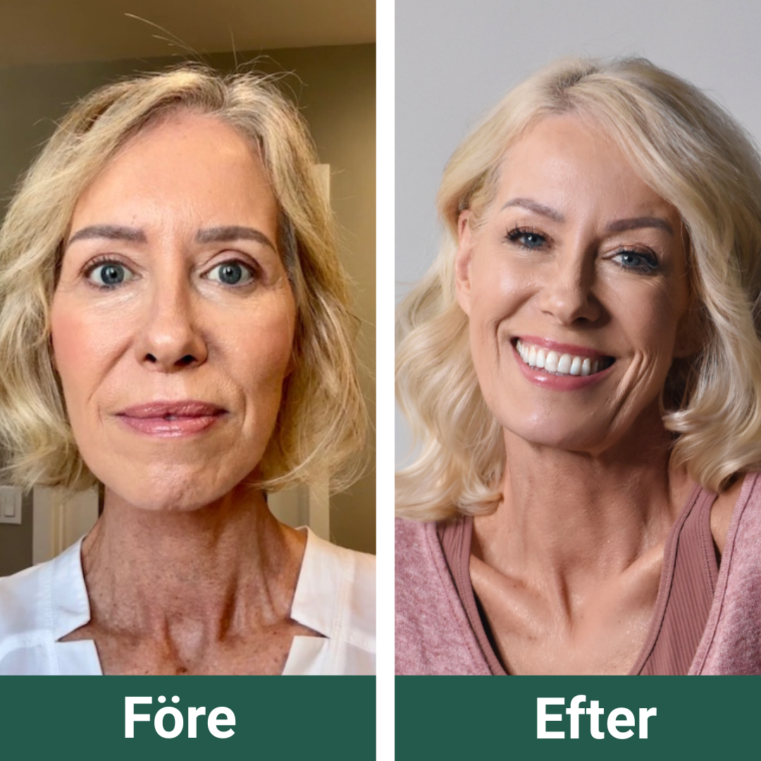 ScalpFlow™ - Naturligt starkare, fylligare & friskare hår